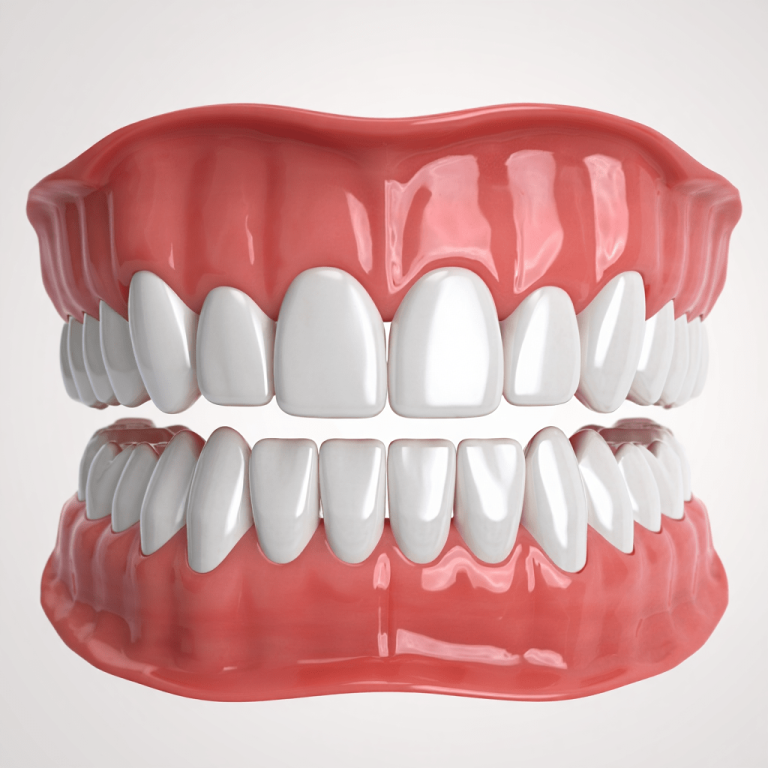 All-on-Four İmplant Tekniği-min