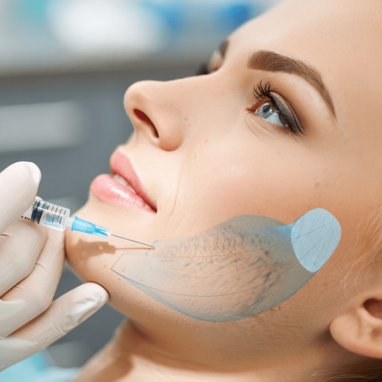 Botoks Tedavileri-min