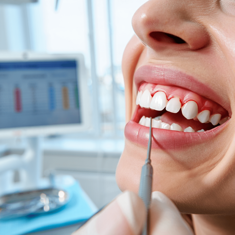 Diş Eti Kanaması-min