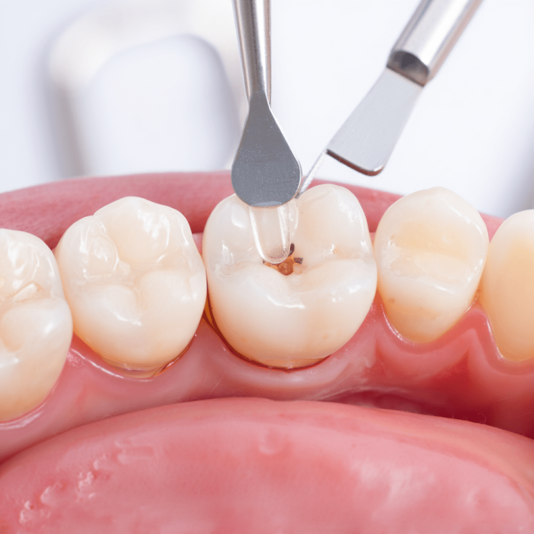 Estetik Dolgular-min