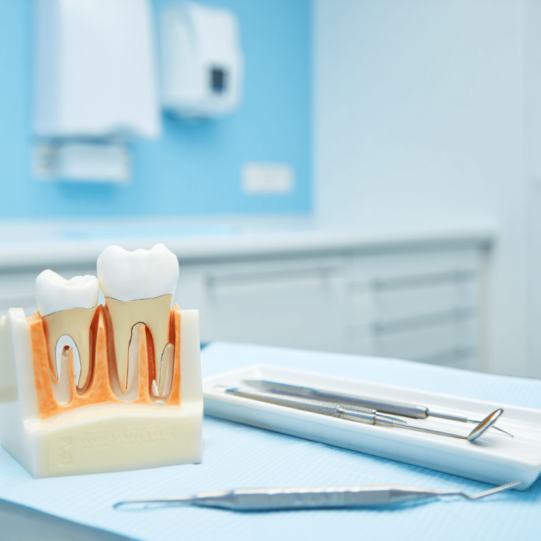 Kanal Tedavisi (Endodonti)-min