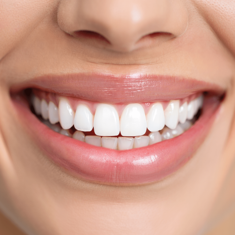 Zirkonyum Dişler-min